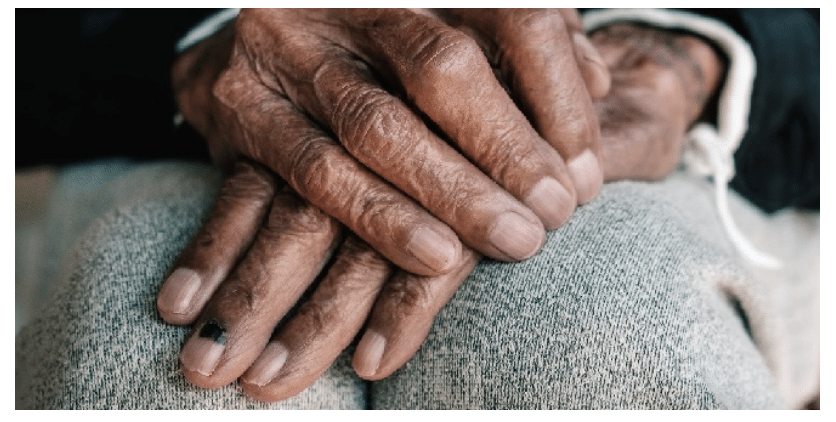 Person's hands folded over each other, emphasising the joints in the hands